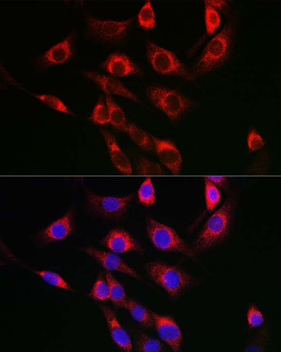 Immunocytochemistry/ Immunofluorescence FBXO6 Antibody - BSA Free