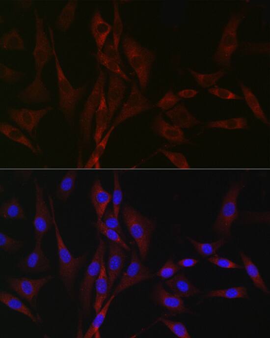 Immunocytochemistry/ Immunofluorescence: Cav3.2 Antibody - Azide and BSA Free [Cav3.2] - Immunofluorescence analysis of NIH/3T3 cells using Cav3.2 Rabbit pAb  at dilution of 1:100 (40x lens). Secondary antibody: Cy3-conjugated Goat anti-Rabbit IgG (H+L)  at 1:500 dilution. Blue: DAPI for nuclear staining.