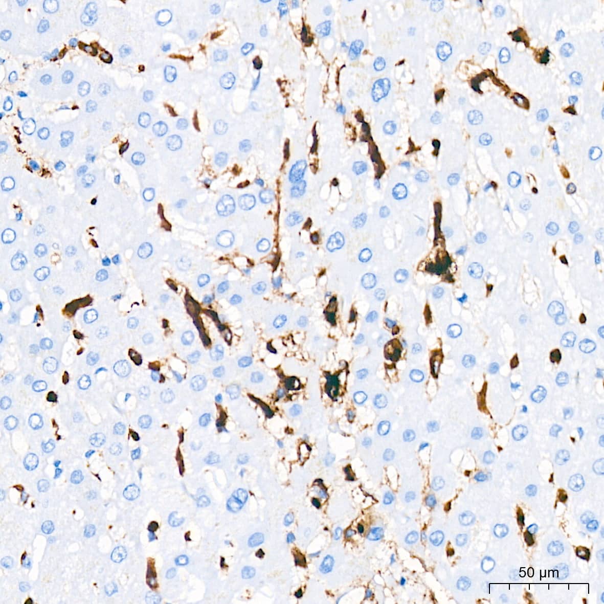 Immunohistochemistry: HLA-DR Antibody (4Y9Y8) [HLA-DR] - Immunohistochemistry analysis of HLA-DR in paraffin-embedded human liver tissue using HLA-DR Rabbit mAb  at a dilution of 1:1600 (40x lens). High pressure antigen retrieval was performed with 0.01 M citrate buffer (pH 6.0) prior to IHC staining.