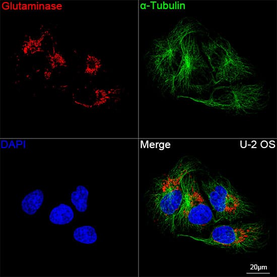 Immunocytochemistry/ Immunofluorescence: Glutaminase Antibody (8R8J6) [NBP3-15340] - Confocal imaging of U-2 OS cells  using Glutaminase Rabbit mAb   followed by a further incubation with Cy3 Goat Anti-Rabbit IgG (H+L) .The cells were counterstained with alpha-Tubulin Mouse mAb  followed by incubation with ABflo 488-conjugated Goat Anti-Mouse IgG (H+L) Ab  (Green).DAPI was used for nuclear staining (Blue). Objective: 100x.