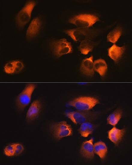 Immunocytochemistry/ Immunofluorescence: AP2M1 Antibody (10J8D1) [AP2M1] - Immunofluorescence analysis of U-251MG cells using AP2M1 Rabbit mAb  at dilution of 1:100 (40x lens). Secondary antibody: Cy3-conjugated Goat anti-Rabbit IgG (H+L)  at 1:500 dilution. Blue: DAPI for nuclear staining.