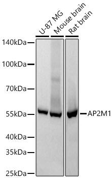 Western Blot: AP2M1 Antibody (10J8D1) [AP2M1] - Western blot analysis of various lysates using AP2M1 Rabbit mAb  at 1:1000 dilution incubated overnight at 4C.Secondary antibody: HRP-conjugated Goat anti-Rabbit IgG (H+L)  at 1:10000 dilution.Lysates/proteins: 25 ug per lane.Blocking buffer: 3% nonfat dry milk in TBST.Detection: ECL Basic Kit .Exposure time: 10s.