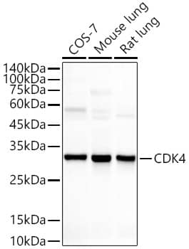 Western Blot: CDK4 Antibody (6N3M6) [CDK4] - Western blot analysis of various lysates, using CDK4 Rabbit mAb  at 1:1000 dilution.Secondary antibody: HRP-conjugated Goat anti-Rabbit IgG (H+L)  at 1:10000 dilution.Lysates/proteins: 25ug per lane.Blocking buffer: 3% nonfat dry milk in TBST.Detection: ECL Basic Kit .Exposure time: 10s.