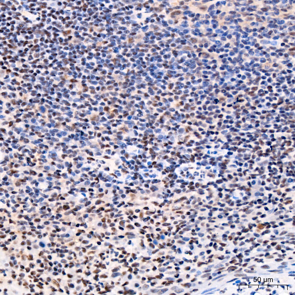 Immunohistochemistry: CDK4 Antibody (6N3M6) [NBP3-15344] - Immunohistochemistry analysis of paraffin-embedded Human tonsil tissue using [KO Validated] CDK4 Rabbit mAb  at a dilution of 1:500 (40x lens). High pressure antigen retrieval performed with 0.01M Citrate Bufferr (pH 6.0) prior to IHC staining.