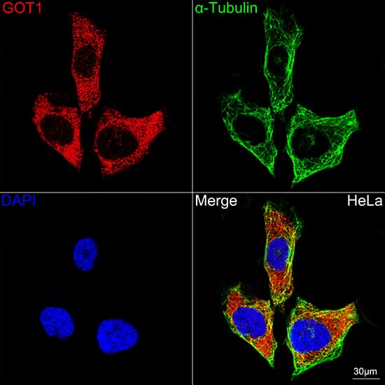 Immunocytochemistry/ Immunofluorescence: Aspartate Aminotransferase Antibody (5J1B4) [NBP3-15347] - Confocal imaging of HeLa cells using Aspartate Aminotransferase Rabbit mAb . The cells were counterstained with alpha-Tubulin Mouse mAb  (Green). DAPI was used for nuclear staining (blue). Objective: 60x.