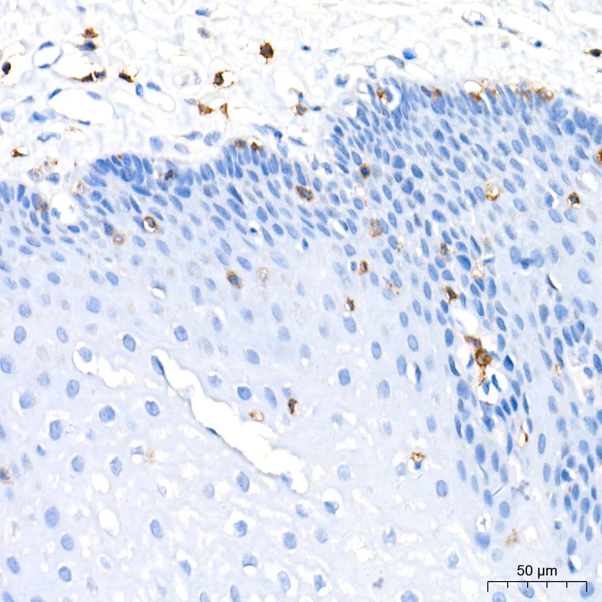Immunohistochemistry: CD3 zeta Antibody (1T5R7) [CD3 zeta] - Immunohistochemistry analysis of paraffin-embedded Human esophagus tissue using CD3 zeta Rabbit mAb  at a dilution of 1:200 (40x lens). High pressure antigen retrieval performed with 0.01M Tris-EDTA Buffer (pH 9.0) prior to IHC staining.