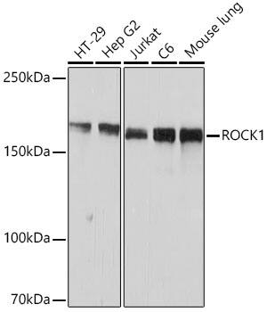 Western Blot: ROCK1 Antibody (H5E4) [ROCK1] - Western blot analysis of various lysates using ROCK1 Rabbit mAb  at 1:1000 dilution.Secondary antibody: HRP-conjugated Goat anti-Rabbit IgG (H+L)  at 1:10000 dilution.Lysates/proteins: 25ug per lane.Blocking buffer: 3% nonfat dry milk in TBST.Detection: ECL Basic Kit .Exposure time: 1s.