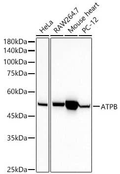 Western Blot: ATPB Antibody (9A1O2) [NBP3-15354] -  analysis of extracts of various cell lines, using ATPB antibody at 1:20000 dilution.Secondary antibody: HRP Goat Anti-Rabbit IgG (H+L) at 1:10000 dilution.Lysates/proteins: 25ug per lane.Blocking buffer: 3% nonfat dry milk in TBST.Detection: ECL Basic Kit. Exposure time: 10s.