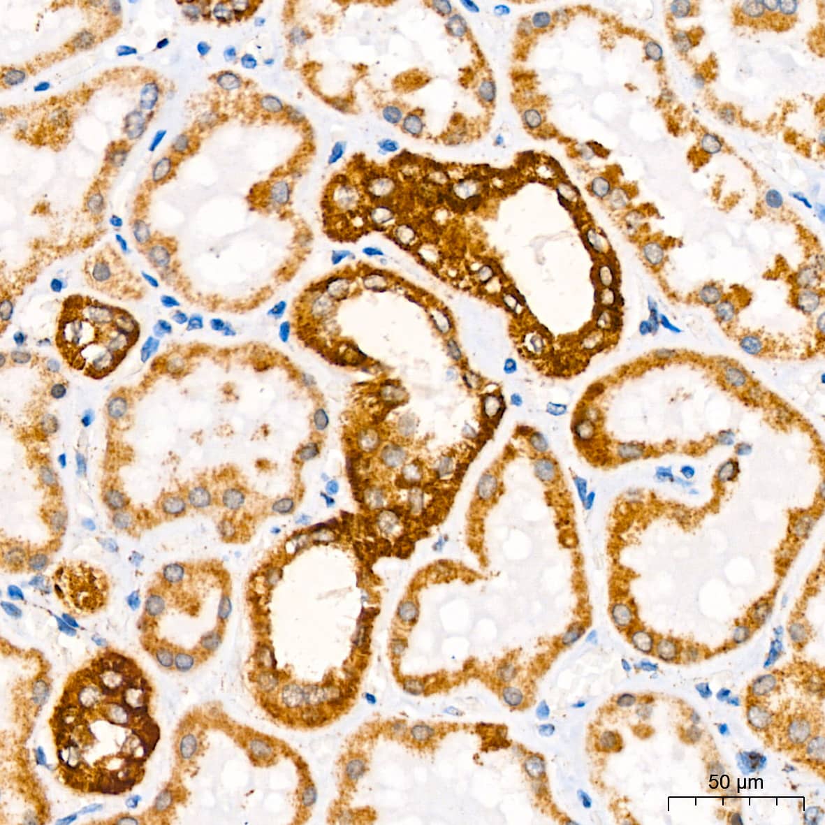 Immunohistochemistry: ATP5A Antibody (6M3B8) [ATP5A] - Immunohistochemistry analysis of paraffin-embedded Human kidney tissue using ATP5A Rabbit mAb  at dilution of 1:200 (40x lens). High pressure antigen retrieval performed with 0.01M Citrate Bufferr (pH 6.0) prior to IHC staining.