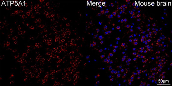 Immunocytochemistry/ Immunofluorescence: ATP5A Antibody (6M3B8) [ATP5A] - Confocal imaging of paraffin-embedded Mouse brain tissue using ATP5A Rabbit mAb  followed by a further incubation with Cy3 Goat Anti-Rabbit IgG (H+L)  . DAPI was used for nuclear staining (Blue). Objective: 40x. Perform microwave antigen retrieval with 0.01 M citrate buffer (pH 6.0) prior to IF staining.