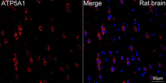 Immunocytochemistry/ Immunofluorescence: ATP5A Antibody (6M3B8) [ATP5A] - Confocal imaging of paraffin-embedded Rat brain tissue using ATP5A Rabbit mAb  followed by a further incubation with Cy3 Goat Anti-Rabbit IgG (H+L)  . DAPI was used for nuclear staining (Blue). Objective: 40x. Perform microwave antigen retrieval with 0.01 M citrate buffer (pH 6.0) prior to IF staining.