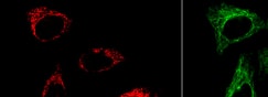 Immunocytochemistry/Immunofluorescence: ATP5A Antibody (6M3B8) [NBP3-15355] - Confocal imaging of HeLa cells using ATP5A1 Rabbit mAb (dilution 1:200) followed by a further incubation with Cy3 Goat Anti-Rabbit IgG (H+L) (dilution 1:500) (Red). The cells were counterstained with  alpha -Tubulin Mouse mAb (dilution 1:400) followed by incubation with ABflo® 488-conjugated Goat Anti-Mouse IgG (H+L) Ab (dilution 1:500) (Green). DAPI was used for nuclear staining (Blue). Objective: 100x.