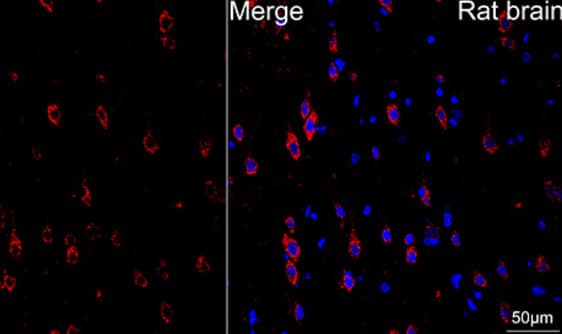 Immunohistochemistry-Paraffin: ATP5A Antibody (6M3B8) [NBP3-15355] -Rat brain tissue using ATP5A1 Rabbit mAb (dilution 1:200) followed by a further incubation with Cy3 Goat Anti-Rabbit IgG (H+L) (dilution 1:500) (Red). DAPI was used for nuclear staining (Blue). Objective: 40x. Perform microwave antigen retrieval with 0.01 M citrate buffer (pH 6.0) prior to IF staining.