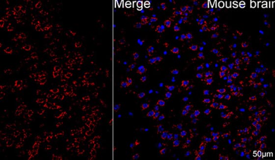 Immunohistochemistry-Paraffin: ATP5A Antibody (6M3B8) [NBP3-15355] - Mouse brain tissue using ATP5A1 Rabbit mAb (dilution 1:200) followed by a further incubation with Cy3 Goat Anti-Rabbit IgG (H+L) ( dilution 1:500) (Red). DAPI was used for nuclear staining (Blue). Objective: 40x. Perform microwave antigen retrieval with 0.01 M citrate buffer (pH 6.0) prior to IF staining.