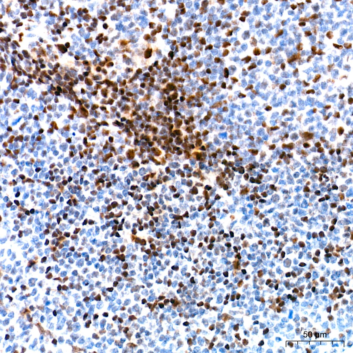 Immunohistochemistry: Ku70/XRCC6 Antibody (8L6B6) [Ku70/XRCC6] - Immunohistochemistry analysis of paraffin-embedded Human tonsil tissue using Ku70/XRCC6 Rabbit mAb  at a dilution of 1:500 (40x lens). High pressure antigen retrieval performed with 0.01M Tris-EDTA Buffer (pH 9.0) prior to IHC staining.