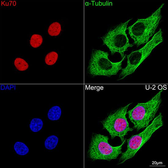 Immunocytochemistry/ Immunofluorescence: Ku70/XRCC6 Antibody (8L6B6) [Ku70/XRCC6] - Confocal imaging of U-2 OS cells using Ku70/XRCC6 Rabbit mAb . The cells were counterstained with alpha-Tubulin Mouse mAb  (Green). DAPI was used for nuclear staining (blue). Objective: 100x.