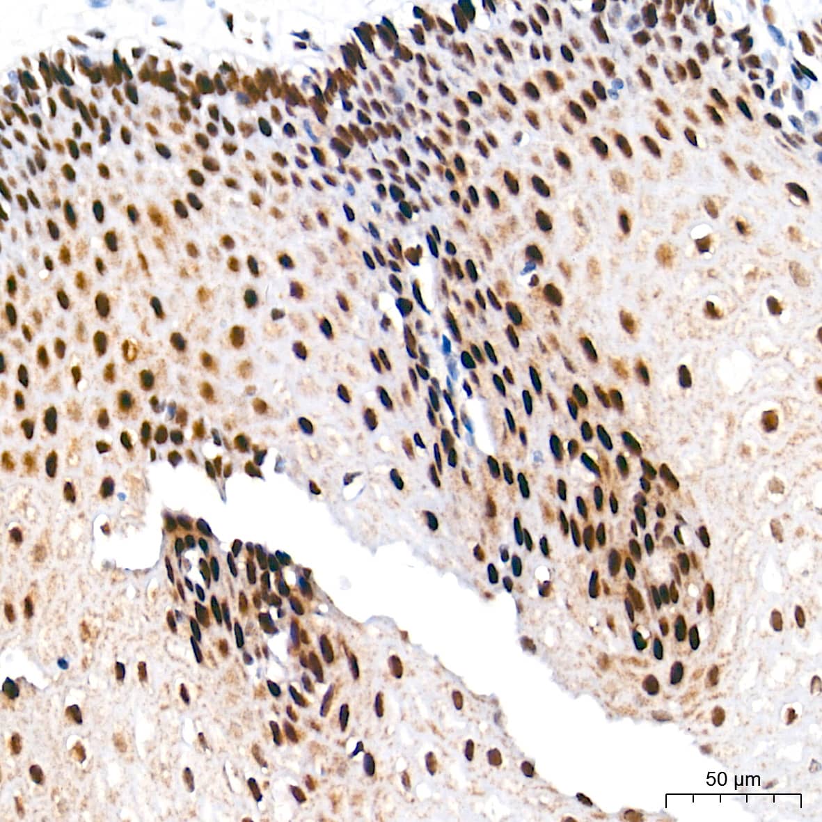 Immunohistochemistry: Ku70/XRCC6 Antibody (8L6B6) [Ku70/XRCC6] - Immunohistochemistry analysis of paraffin-embedded Human esophagus tissue using Ku70/XRCC6 Rabbit mAb  at a dilution of 1:500 (40x lens). High pressure antigen retrieval performed with 0.01M Tris-EDTA Buffer (pH 9.0) prior to IHC staining.