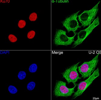 Immunocytochemistry/Immunofluorescence: Ku70/XRCC6 Antibody (8L6B6) [NBP3-15358] -Confocal imaging of U-2 OS cells using Ku70 Rabbit mAb (dilution 1:100)(Red). The cells were counterstained with  alpha -Tubulin Mouse mAb (dilution 1:400) (Green). DAPI was used for nuclear staining (blue). Objective: 100x.