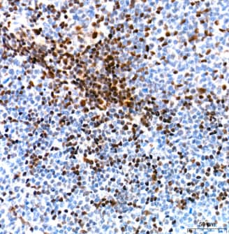 Immunohistochemistry-Paraffin: Ku70/XRCC6 Antibody (8L6B6) [NBP3-15358] -Analysis of paraffin-embedded Human tonsil tissue using Ku70 Rabbit mAb at a dilution of 1:500 (40x lens). High pressure antigen retrieval performed with 0.01M Tris-EDTA Buffer (pH 9.0) prior to IHC staining.