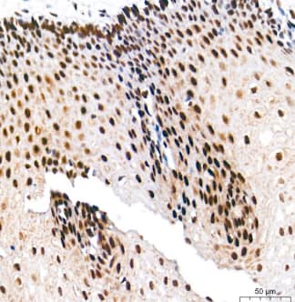 Immunohistochemistry-Paraffin: Ku70/XRCC6 Antibody (8L6B6) [NBP3-15358] -Analysis of paraffin-embedded Human esophagus tissue using Ku70 Rabbit mAb at a dilution of 1:500 (40x lens). High pressure antigen retrieval performed with 0.01M Tris-EDTA Buffer (pH 9.0) prior to IHC staining.