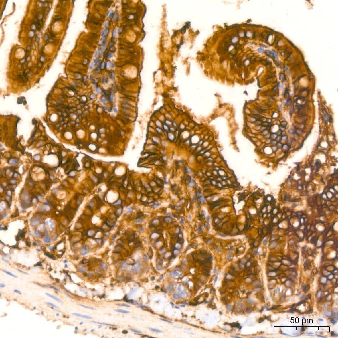 Immunohistochemistry: Annexin A2 Antibody (1W2B5) [Annexin A2] - Immunohistochemistry analysis of paraffin-embedded Mouse colon tissue using Annexin A2 Rabbit mAb  at a dilution of 1:800 (40x lens). High pressure antigen retrieval performed with 0.01M Citrate Bufferr (pH 6.0) prior to IHC staining.