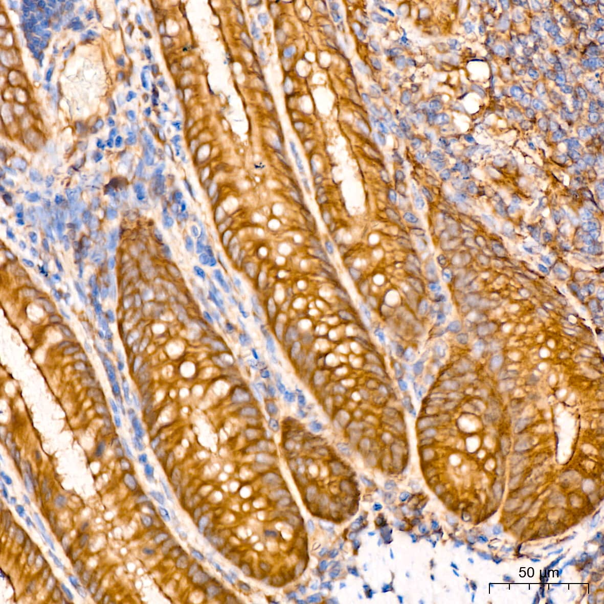 Immunohistochemistry: Annexin A2 Antibody (1W2B5) [Annexin A2] - Immunohistochemistry analysis of paraffin-embedded Rat colon tissue using Annexin A2 Rabbit mAb  at a dilution of 1:800 (40x lens). High pressure antigen retrieval performed with 0.01M Citrate Bufferr (pH 6.0) prior to IHC staining.