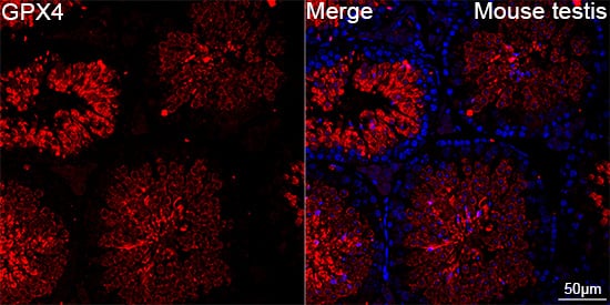Immunocytochemistry/ Immunofluorescence: Glutathione Peroxidase 4/GPX4 Antibody (7O4Q9) [NBP3-15362] - Confocal imaging of paraffin-embedded Mouse testis tissue using [KD Validated] Glutathione Peroxidase 4/GPX4 Rabbit mAb  followed by a further incubation with Cy3 Goat Anti-Rabbit IgG (H+L)  . DAPI was used for nuclear staining (Blue). High pressure antigen retrieval performed with 0.01M Citrate Buffer (pH 6.0) prior to IF staining. Objective: 40x.