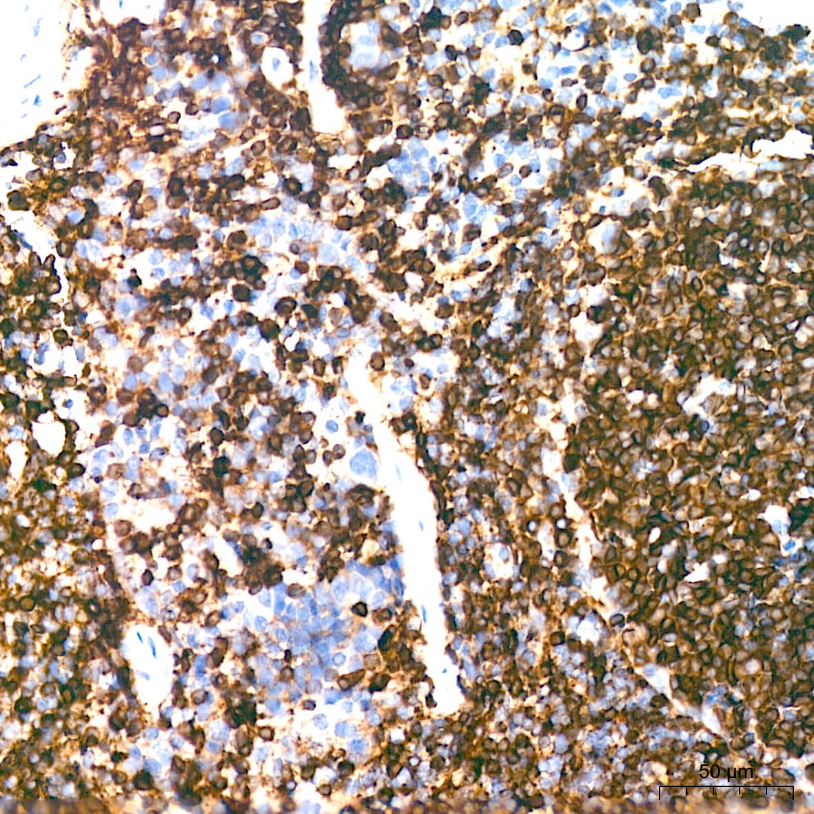 Immunohistochemistry: HLA DQA1 Antibody (7W0M7) [HLA DQA1] - Immunohistochemistry analysis of paraffin-embedded Mouse spleen tissue using HLA DQA1 Rabbit mAb  at a dilution of 1:200 (40x lens). High pressure antigen retrieval performed with 0.01M Citrate Bufferr (pH 6.0) prior to IHC staining.