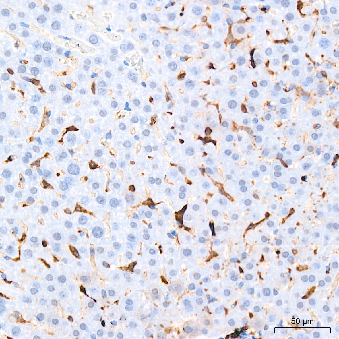 Immunohistochemistry: HLA DQA1 Antibody (7W0M7) [HLA DQA1] - Immunohistochemistry analysis of paraffin-embedded Mouse liver tissue using HLA DQA1 Rabbit mAb  at a dilution of 1:200 (40x lens). High pressure antigen retrieval performed with 0.01M Citrate Bufferr (pH 6.0) prior to IHC staining.