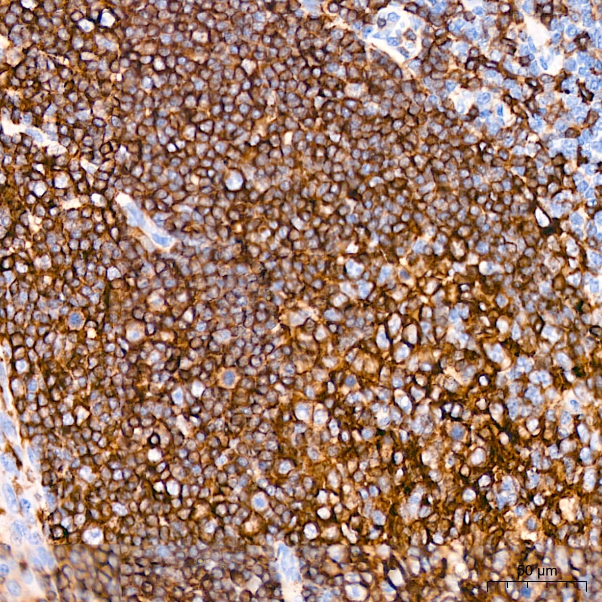 Immunohistochemistry: HLA DQA1 Antibody (7W0M7) [HLA DQA1] - Immunohistochemistry analysis of paraffin-embedded Human tonsil tissue using HLA DQA1 Rabbit mAb  at a dilution of 1:200 (40x lens). High pressure antigen retrieval performed with 0.01M Citrate Bufferr (pH 6.0) prior to IHC staining.