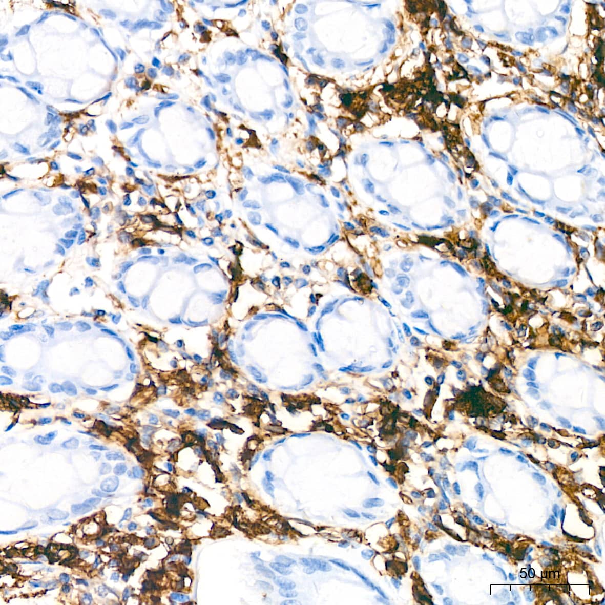 Immunohistochemistry: HLA DQA1 Antibody (7W0M7) [HLA DQA1] - Immunohistochemistry analysis of paraffin-embedded Human colon tissue using HLA DQA1 Rabbit mAb  at a dilution of 1:200 (40x lens). High pressure antigen retrieval performed with 0.01M Citrate Bufferr (pH 6.0) prior to IHC staining.