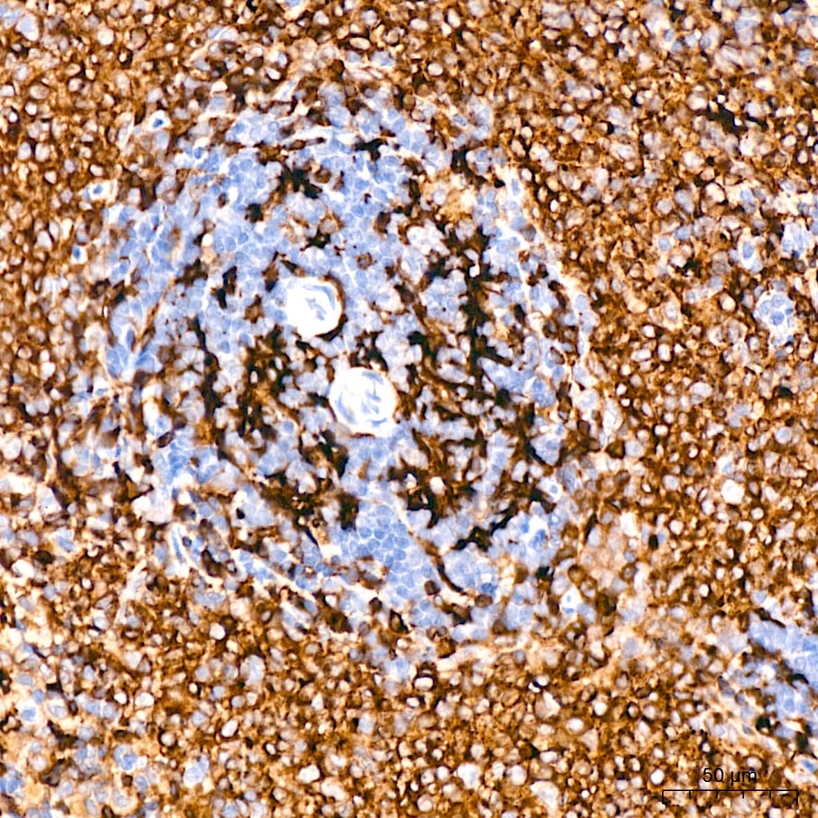 Immunohistochemistry: HLA DQA1 Antibody (7W0M7) [HLA DQA1] - Immunohistochemistry analysis of paraffin-embedded Rat spleen tissue using HLA DQA1 Rabbit mAb  at a dilution of 1:200 (40x lens). High pressure antigen retrieval performed with 0.01M Citrate Bufferr (pH 6.0) prior to IHC staining.