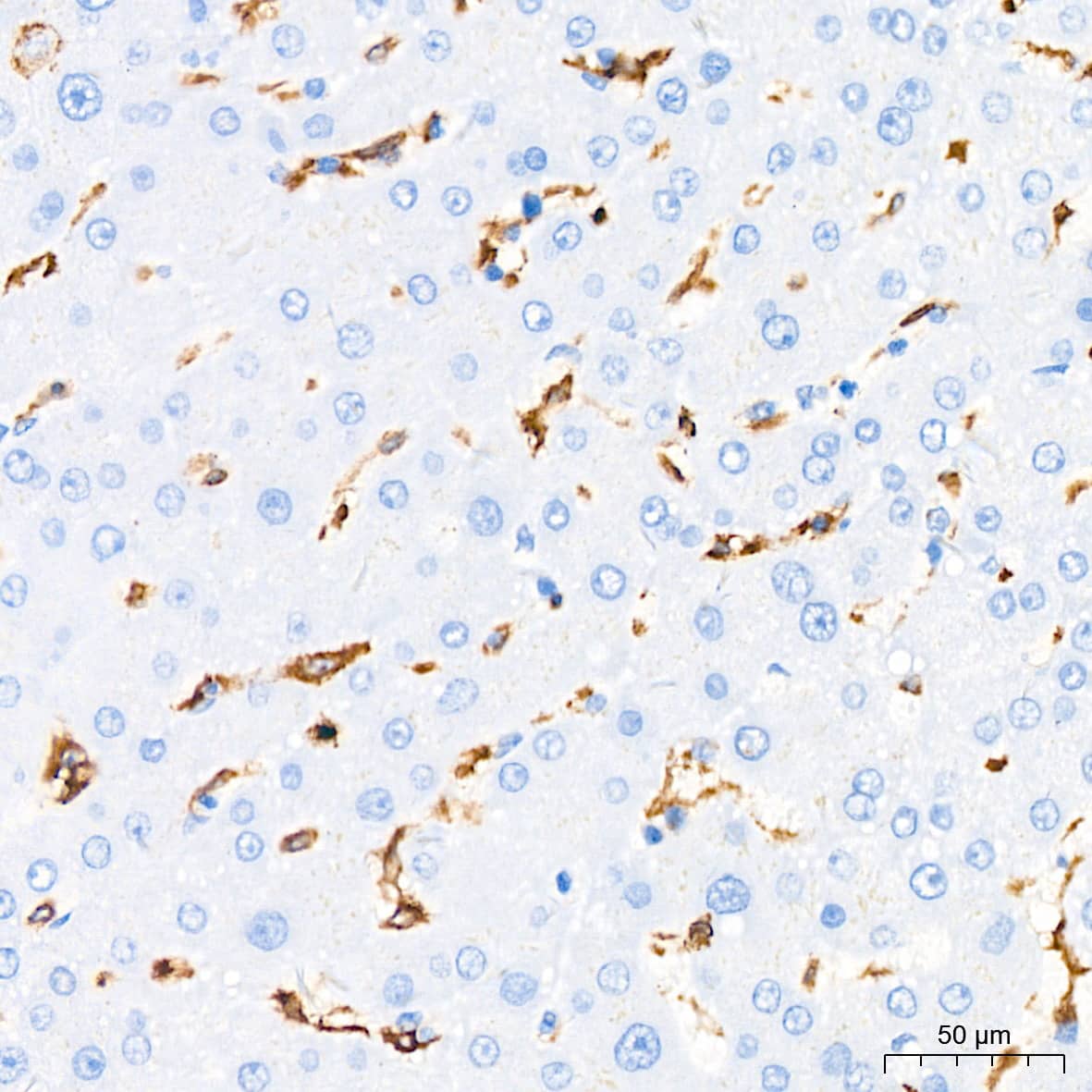 Immunohistochemistry: HLA DQA1 Antibody (7W0M7) [HLA DQA1] - Immunohistochemistry analysis of paraffin-embedded Human liver tissue using HLA DQA1 Rabbit mAb  at a dilution of 1:200 (40x lens). High pressure antigen retrieval performed with 0.01M Citrate Bufferr (pH 6.0) prior to IHC staining.