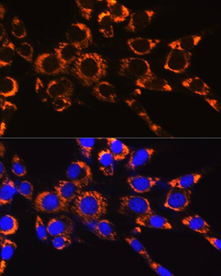 Immunocytochemistry/ Immunofluorescence: IDH2 Antibody (8C3D4) [IDH2] - Immunofluorescence analysis of NIH-3T3 cells using IDH2 Rabbit mAb  at dilution of 1:100 (40x lens). Secondary antibody: Cy3 Goat Anti-Rabbit IgG (H+L)  at 1:500 dilution. Blue: DAPI for nuclear staining.