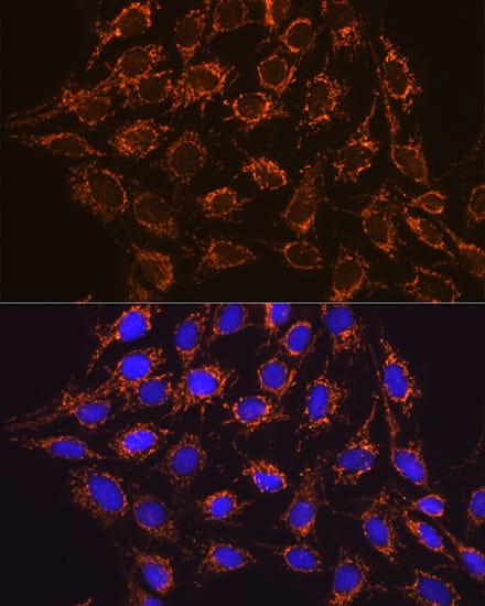 Immunocytochemistry/ Immunofluorescence: IDH2 Antibody (8C3D4) [IDH2] - Immunofluorescence analysis of C6 cells using IDH2 Rabbit mAb  at dilution of 1:100 (40x lens). Secondary antibody: Cy3 Goat Anti-Rabbit IgG (H+L)  at 1:500 dilution. Blue: DAPI for nuclear staining.