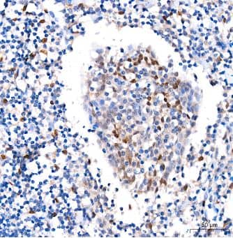 Immunohistochemistry-Paraffin: FGF basic/FGF2/bFGF Antibody (8W6M5) [NBP3-15367] -Human tonsil tissue using FGF2 Rabbit mAb at a dilution of 1:200 (40x lens). High pressure antigen retrieval was performed with 0.01 M citrate buffer (pH 6.0) prior to IHC staining.