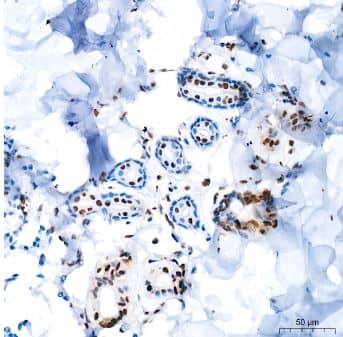 Immunohistochemistry-Paraffin: FGF basic/FGF2/bFGF Antibody (8W6M5) [NBP3-15367] - Human skin tissue using FGF2 Rabbit mAb at a dilution of 1:200 (40x lens). High pressure antigen retrieval was performed with 0.01 M citrate buffer (pH 6.0) prior to IHC staining.