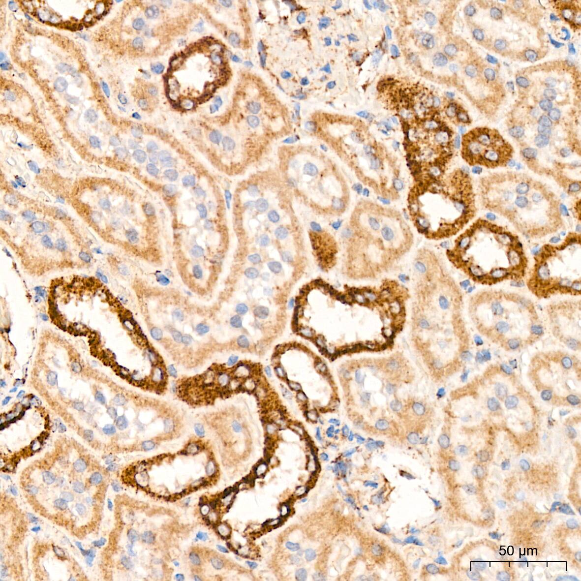 Immunohistochemistry: HABP1/C1QBP/GC1q R Antibody (6N7U3) [NBP3-15368] - Immunohistochemistry analysis of HABP1/C1QBP/GC1q R in paraffin-embedded rat kidney tissue using HABP1/C1QBP/GC1q R Rabbit mAb  at a dilution of 1:200 (40x lens). High pressure antigen retrieval was performed with 0.01 M citrate buffer (pH 6.0) prior to IHC staining.