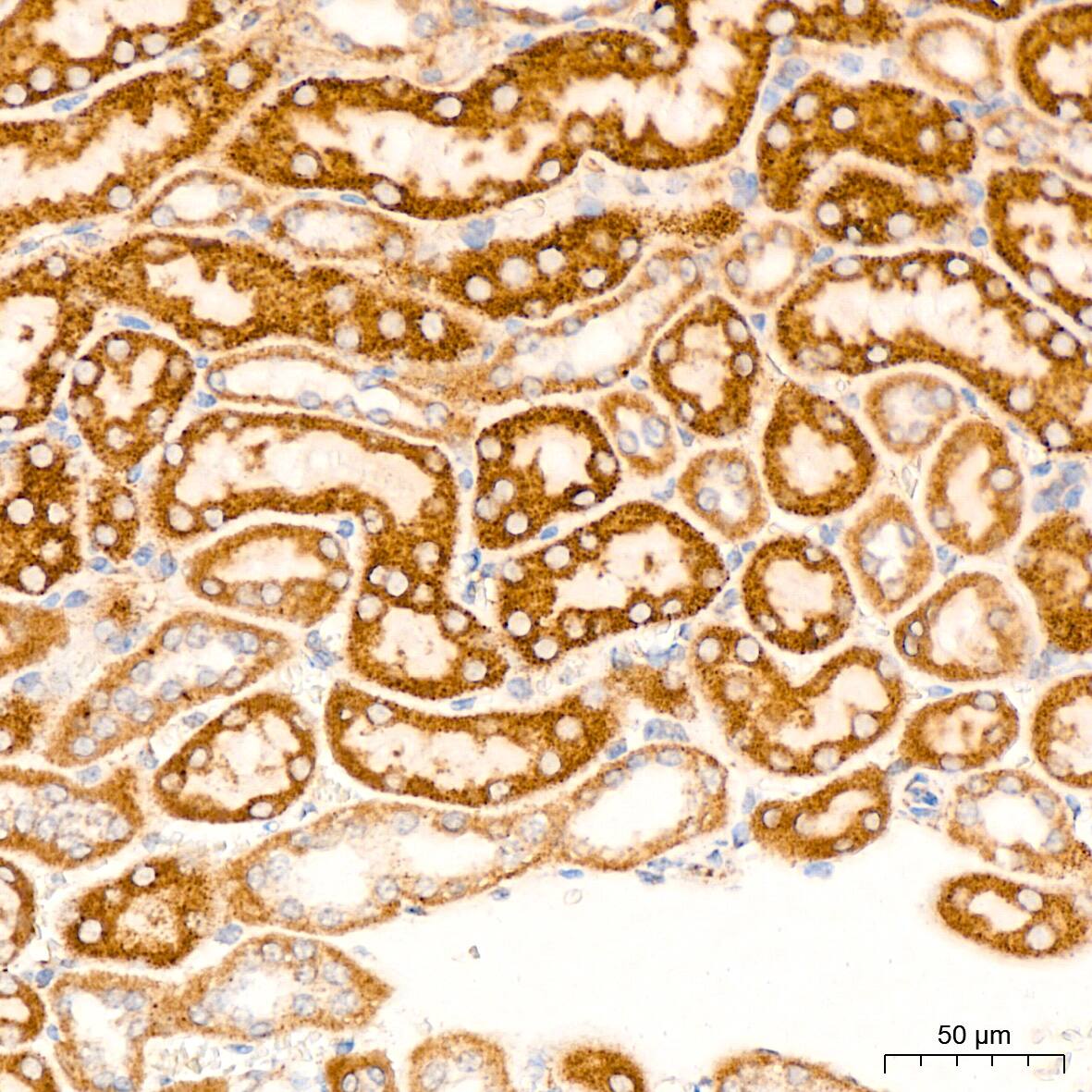 Immunohistochemistry: HABP1/C1QBP/GC1q R Antibody (6N7U3) [NBP3-15368] - Immunohistochemistry analysis of HABP1/C1QBP/GC1q R in paraffin-embedded mouse kidney tissue using HABP1/C1QBP/GC1q R Rabbit mAb  at a dilution of 1:200 (40x lens). High pressure antigen retrieval was performed with 0.01 M citrate buffer (pH 6.0) prior to IHC staining.