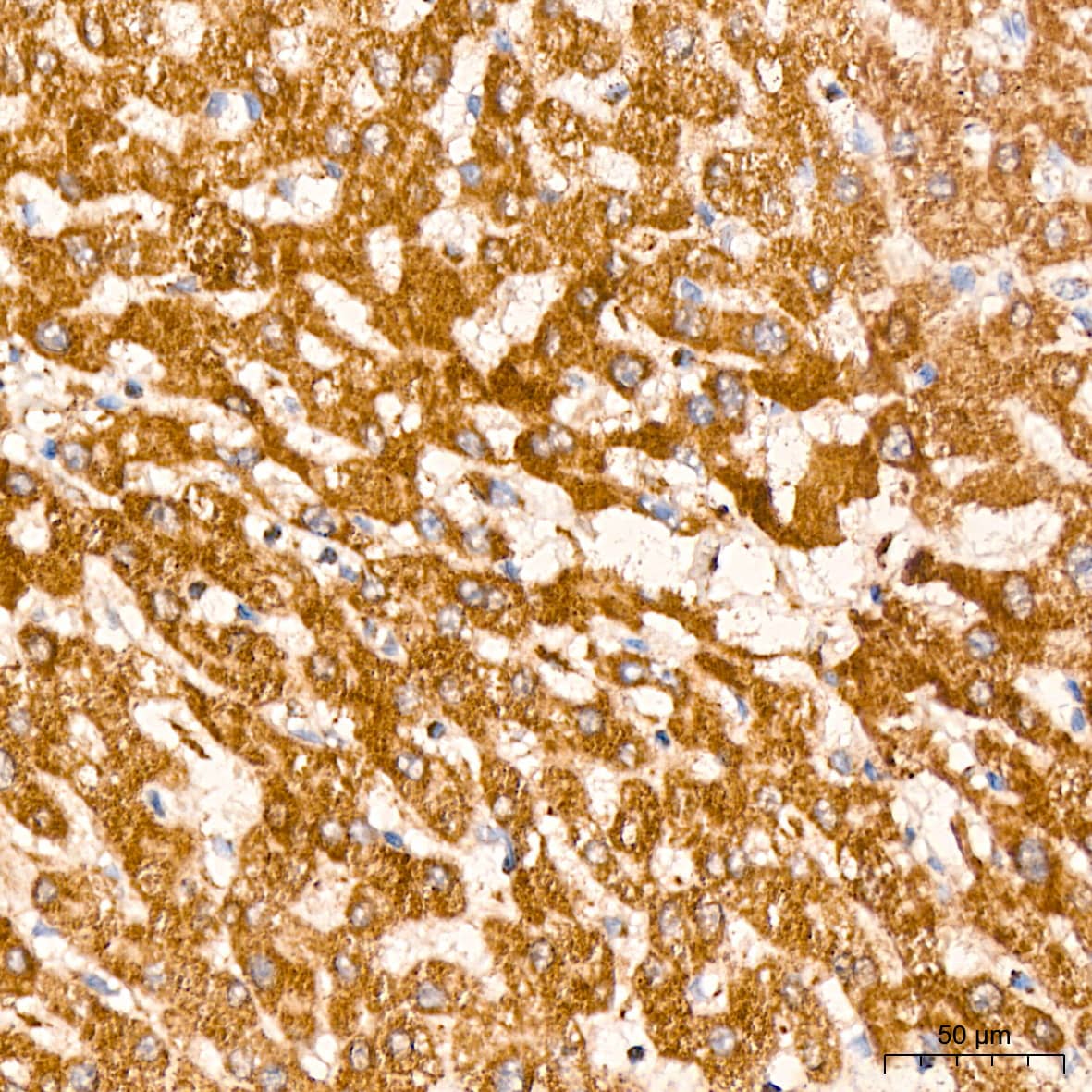 Immunohistochemistry: HABP1/C1QBP/GC1q R Antibody (6N7U3) [NBP3-15368] - Immunohistochemistry analysis of HABP1/C1QBP/GC1q R in paraffin-embedded human liver tissue using HABP1/C1QBP/GC1q R Rabbit mAb  at a dilution of 1:200 (40x lens). High pressure antigen retrieval was performed with 0.01 M citrate buffer (pH 6.0) prior to IHC staining.