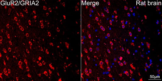 Immunocytochemistry/ Immunofluorescence: GluR2 Antibody (9R1X2) [GluR2] - Confocal imaging of paraffin-embedded Rat brain tissue using GluR2 Rabbit mAb  followed by a further incubation with Cy3 Goat Anti-Rabbit IgG (H+L)  . DAPI was used for nuclear staining (Blue). Objective: 40x. Perform microwave antigen retrieval with 0.01 M citrate buffer (pH 6.0) prior to IF staining.