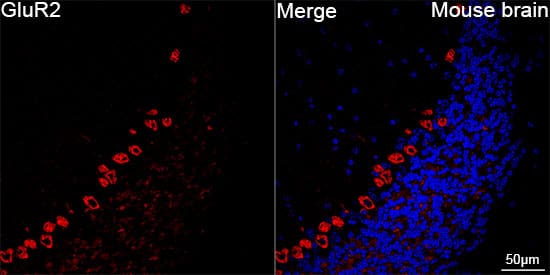 Immunocytochemistry/ Immunofluorescence: GluR2 Antibody (9R1X2) [GluR2] - Confocal imaging of paraffin-embedded Mouse brain tissue using GluR2 Rabbit mAb  followed by a further incubation with Cy3 Goat Anti-Rabbit IgG (H+L)  . DAPI was used for nuclear staining (Blue). Objective: 40x. Perform microwave antigen retrieval with 0.01 M citrate buffer (pH 6.0) prior to IF staining.