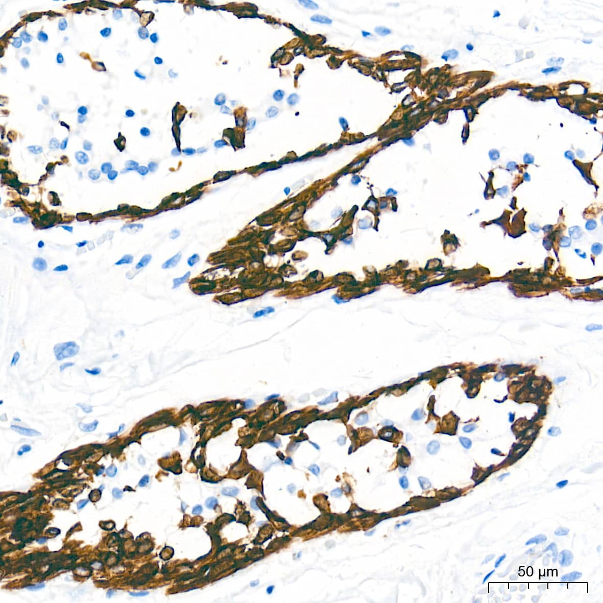 Immunohistochemistry: Cytokeratin 5 Antibody (3P3T9) [Cytokeratin 5] - Immunohistochemistry analysis of paraffin-embedded Human breast tissue using Cytokeratin 5 Rabbit mAb  at a dilution of 1:2000 (40x lens). High pressure antigen retrieval performed with 0.01M Tris-EDTA Buffer (pH 9.0) prior to IHC staining.