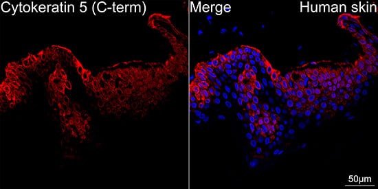 Immunocytochemistry/ Immunofluorescence: Cytokeratin 5 Antibody (3P3T9) [Cytokeratin 5] - Confocal imaging of paraffin-embedded Human skin using Cytokeratin 5 Rabbit mAb  followed by a further incubation with Cy3 Goat Anti-Rabbit IgG (H+L)  . DAPI was used for nuclear staining (Blue). Objective: 40x.Perform high pressure antigen retrieval with 0.01M citrate buffer (pH 6.0) prior to IF staining.