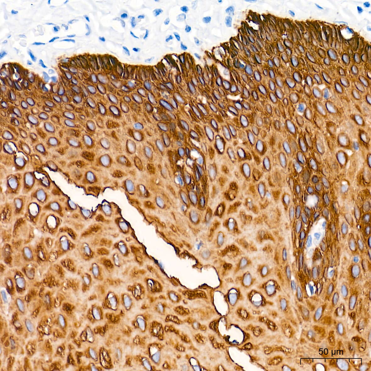 Immunohistochemistry: Cytokeratin 5 Antibody (3P3T9) [Cytokeratin 5] - Immunohistochemistry analysis of paraffin-embedded Human esophagus tissue using Cytokeratin 5 Rabbit mAb  at a dilution of 1:2000 (40x lens). High pressure antigen retrieval performed with 0.01M Tris-EDTA Buffer (pH 9.0) prior to IHC staining.