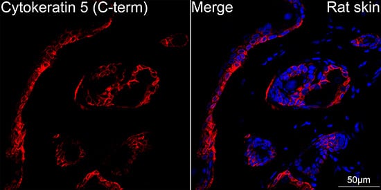 Immunocytochemistry/ Immunofluorescence: Cytokeratin 5 Antibody (3P3T9) [Cytokeratin 5] - Confocal imaging of paraffin-embedded Rat skin using Cytokeratin 5 Rabbit mAb  followed by a further incubation with Cy3 Goat Anti-Rabbit IgG (H+L)  . DAPI was used for nuclear staining (Blue). Objective: 40x.Perform high pressure antigen retrieval with 0.01M citrate buffer (pH 6.0) prior to IF staining.