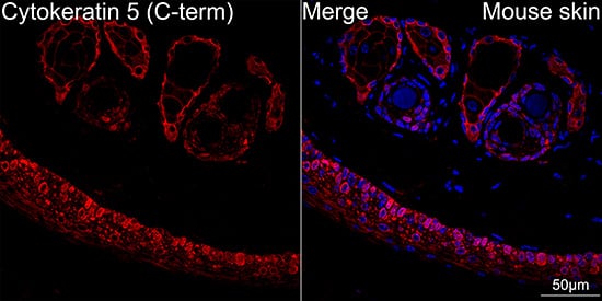 Immunocytochemistry/ Immunofluorescence: Cytokeratin 5 Antibody (3P3T9) [Cytokeratin 5] - Confocal imaging of paraffin-embedded Mouse skin using Cytokeratin 5 Rabbit mAb  followed by a further incubation with Cy3 Goat Anti-Rabbit IgG (H+L)  . DAPI was used for nuclear staining (Blue). Objective: 40x.Perform high pressure antigen retrieval with 0.01M citrate buffer (pH 6.0) prior to IF staining.