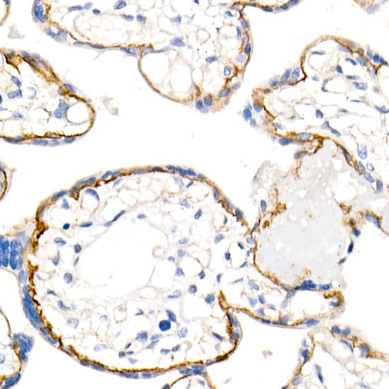 Immunohistochemistry: p120-catenin Antibody (5N7Z0) [p120-catenin] - Immunohistochemistry analysis of paraffin-embedded Human placenta using p120-catenin Rabbit mAb  at dilution of 1:100 (40x lens). High pressure antigen retrieval performed with 0.01M Tris/EDTA Buffer (pH 9.0) prior to IHC staining.