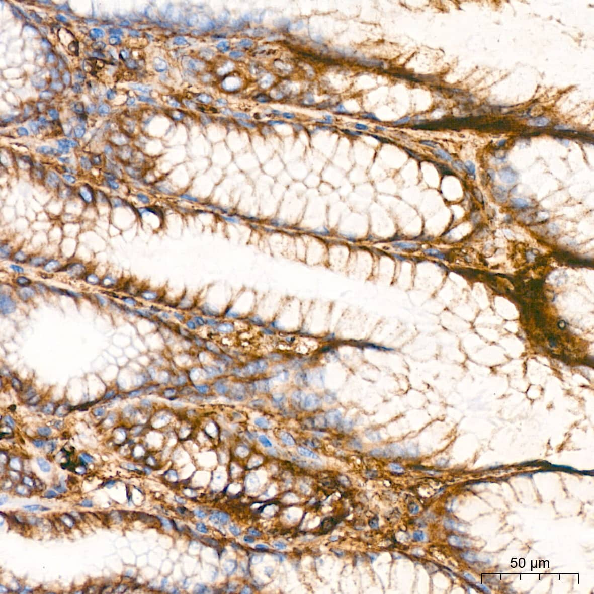 Immunohistochemistry: HLA A Antibody (8L2H2) [HLA A] - Immunohistochemistry analysis of paraffin-embedded Human stomach tissue using HLA A Rabbit mAb  at a dilution of 1:200 (40x lens). High pressure antigen retrieval was performed with 0.01 M citrate buffer (pH 6.0) prior to IHC staining.