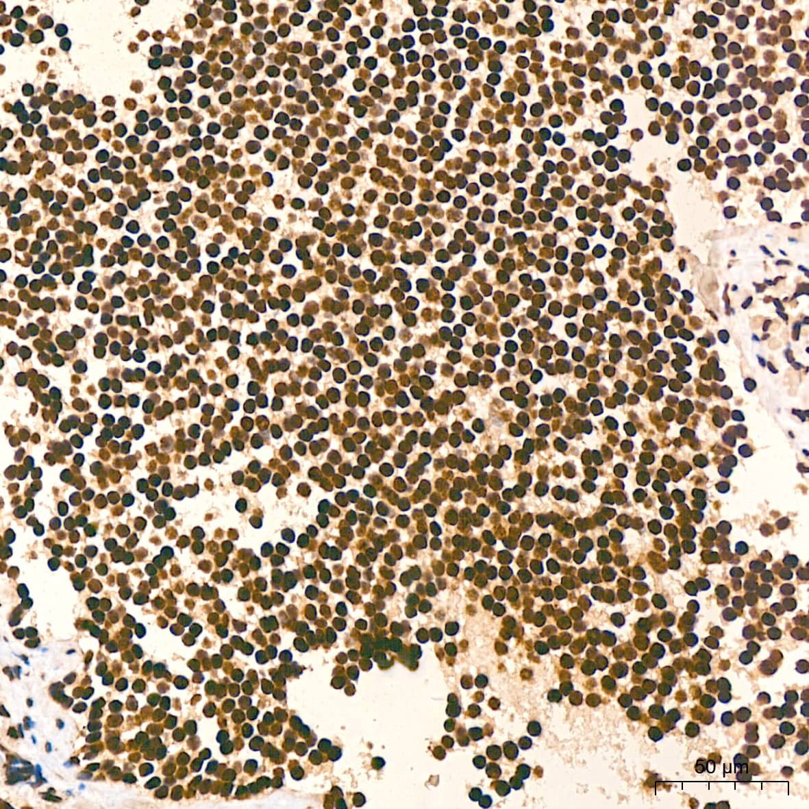 Immunohistochemistry: Histone H2AX Antibody (4Z3S8) [Histone H2AX] - Immunohistochemistry analysis of paraffin-embedded Human tonsil tissue using Histone H2AX Rabbit mAb  at a dilution of 1:800 (40x lens). High pressure antigen retrieval performed with 0.01M Citrate Bufferr (pH 6.0) prior to IHC staining.